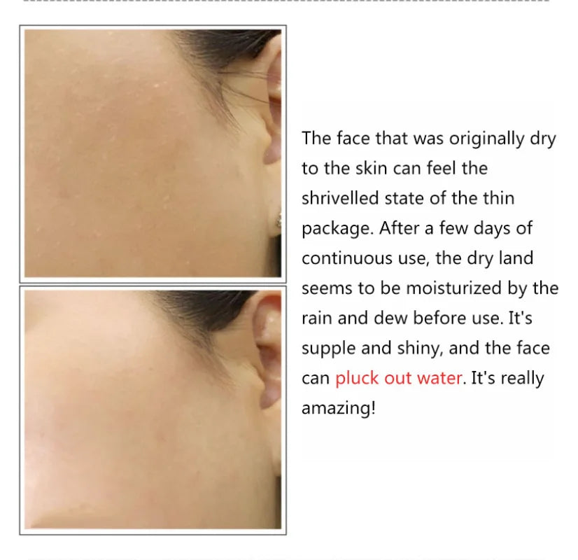 Hyaluronic Acid + B5 Skin Care Serum